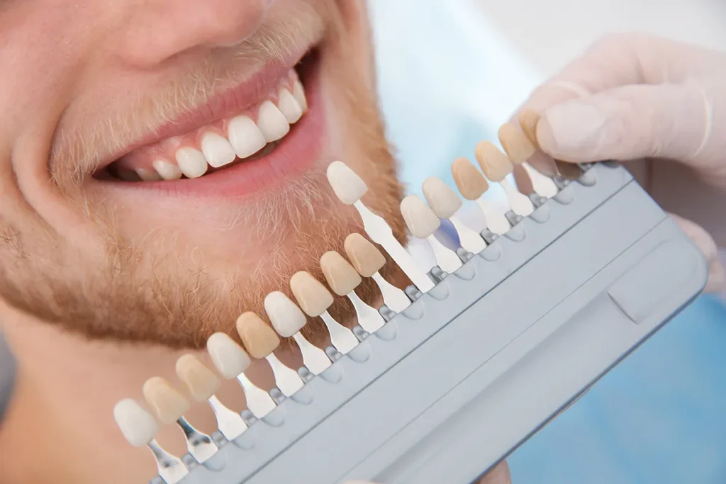 dentist-selecting-patient-s-teeth-color-with-palet