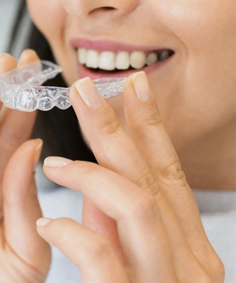 woman about to put in invisalign into her mouth