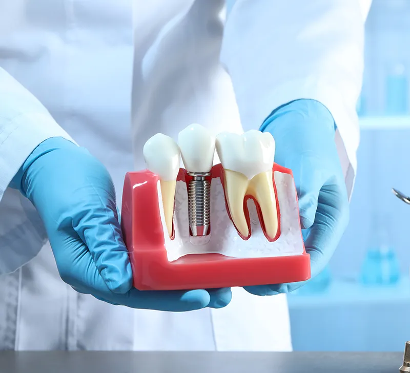 dentist holding dental implants